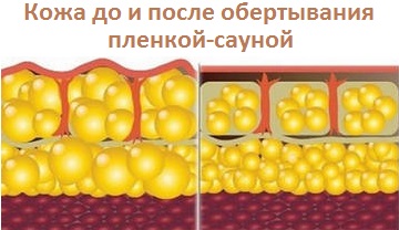 Клетки кожи до процедуры и после