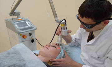 Удаление жировика лазером Удаление жировика лазером