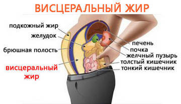 Строение живота с висцеральным жиром