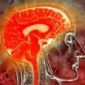 Гипертензивная энцефалопатия Гипертензивная энцефалопатия