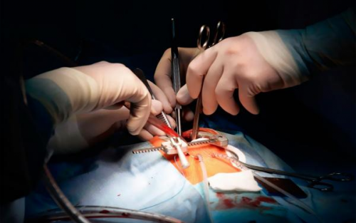 Операция аортокоронарного шунтирования Операция аортокоронарного шунтирования