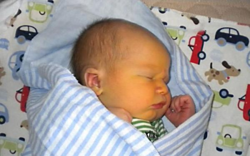 Желтуха у новорожденного Желтуха у новорожденного