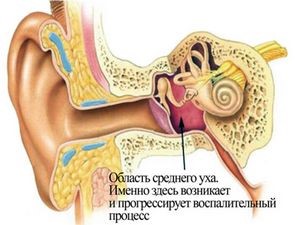 Цефтриаксон при отите у взрослых: показания и побочное действие Цефтриаксон при отите у взрослых: показания и побочное действие