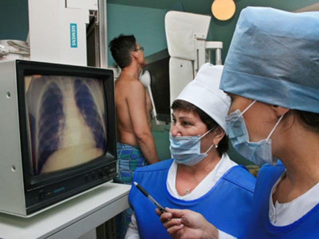 Необходимость проведения флюорографии при пневмонии Необходимость проведения флюорографии при пневмонии
