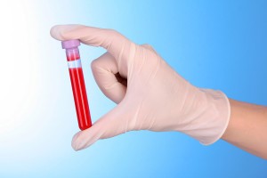 Что показывает уровень гликозилированного гемоглобина? Что показывает уровень гликозилированного гемоглобина?