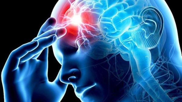 Причины инсульта головного мозга Причины инсульта головного мозга