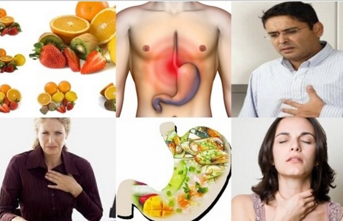 Как избавиться от изжоги на дому? Самые эффективные народные методы Как избавиться от изжоги на дому? Самые эффективные народные методы