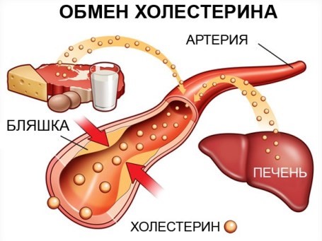 Народные рецепты для снижения показателей холестерина Народные рецепты для снижения показателей холестерина