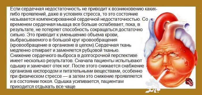 Кашель при сердечной недостаточности Кашель при сердечной недостаточности