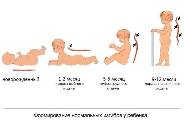 Сколиоз кифоз Сколиоз кифоз
