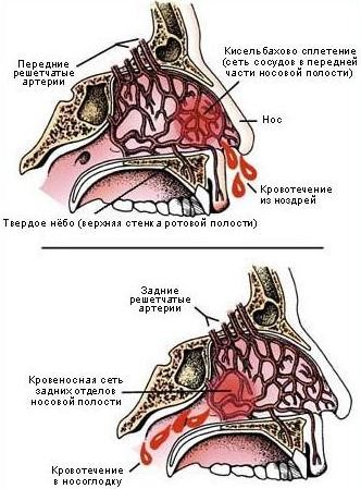 Почему возможно развитие кровотечений из носа? Почему возможно развитие кровотечений из носа?
