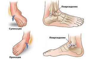 Связки голеностопного сустава Связки голеностопного сустава