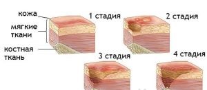Заживление повреждений кожи: мнение врача Заживление повреждений кожи: мнение врача