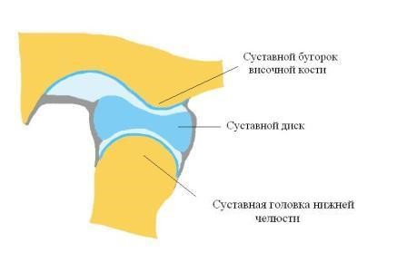 Остеоартроз височно-нижнечелюстного сустава: лечение ВНЧС Остеоартроз височно-нижнечелюстного сустава: лечение ВНЧС