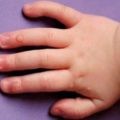 Симптомы и лечение камней в мочевом пузыре Симптомы и лечение камней в мочевом пузыре