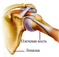 Периартрит стопы Периартрит стопы