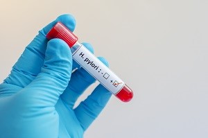 Прогноз при перстневидноклеточном раке желудка Прогноз при перстневидноклеточном раке желудка