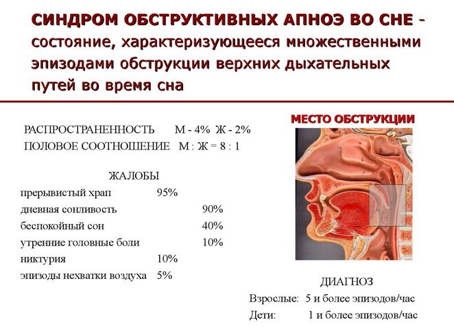 10 основных причин храпа во сне 10 основных причин храпа во сне