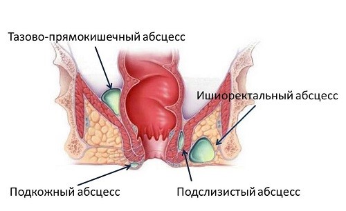 Диагностическая процедура колоноскопии кишечника Диагностическая процедура колоноскопии кишечника