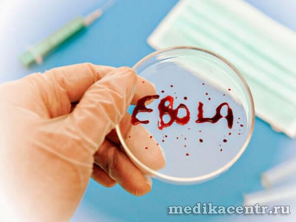 Причины и симптомы пневмонии у детей Причины и симптомы пневмонии у детей