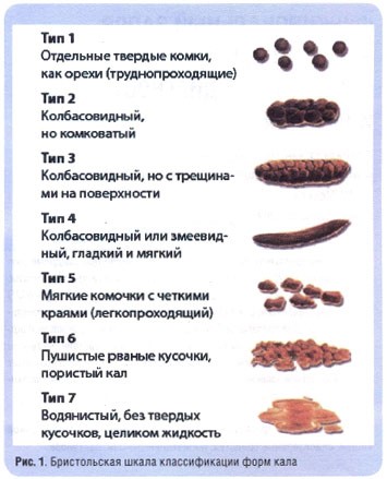 Запор с кровью у детей Запор с кровью у детей