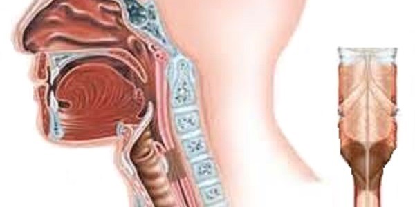 Причины, признаки, диагностика, способы лечения и профилактики стеноза трахеи Причины, признаки, диагностика, способы лечения и профилактики стеноза трахеи