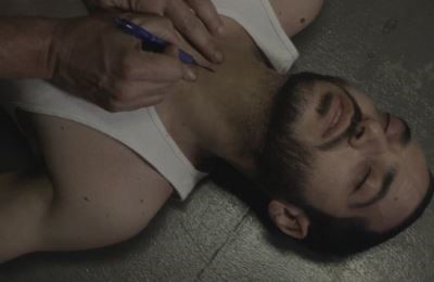 Причины, признаки, диагностика, способы лечения и профилактики стеноза трахеи Причины, признаки, диагностика, способы лечения и профилактики стеноза трахеи