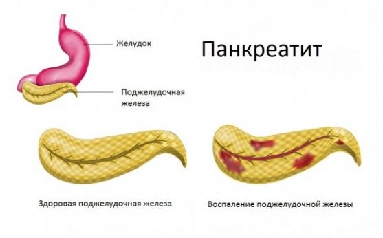 Причины тошноты и тяжести в желудке Причины тошноты и тяжести в желудке