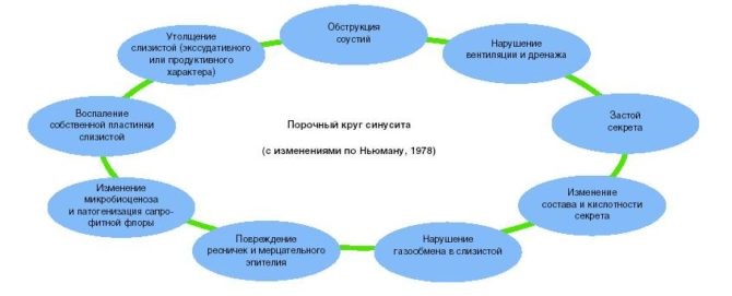 Причины возникновения верхнечелюстного синусита у взрослых Причины возникновения верхнечелюстного синусита у взрослых
